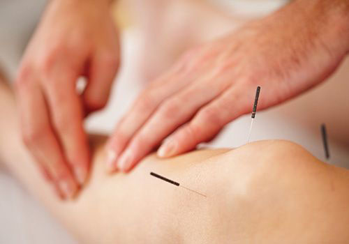 acupuncture on knee